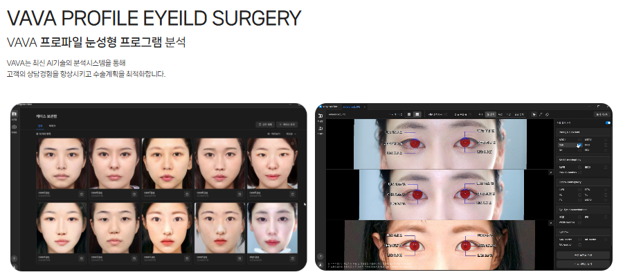 Concerned About Eyes That Look Narrow and Constricted? | When a Lateral Canthoplasty & Lower Canthoplasty May Be Needed at Baba Plastic Surgery Clinic image 10