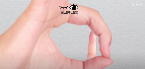 쌍수 후 생겨버린 짝눈 교정 눈의 균형을 맞추는 섬세한 방식 관련 이미지 25