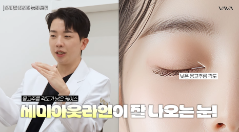 과하지 않게 또렷한 눈매, 세미아웃라인&middot;인아웃라인 쌍꺼풀 인기 이유 관련 이미지 9