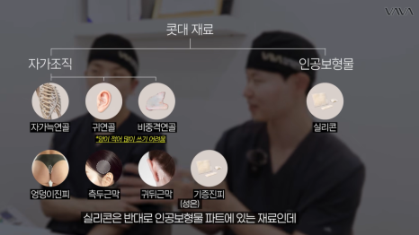 코성형 재료 총정리｜실리콘 부작용&middot;자가늑연골 와핑&middot;귀연골 흡수까지 (콧대 코끝 비교) 관련 이미지 3