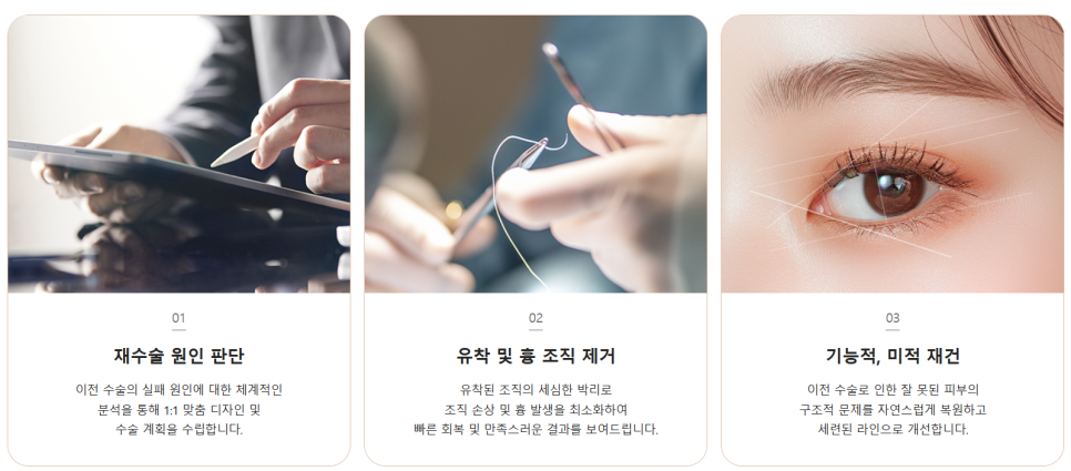 눈 재수술로 보다 완벽한 눈매라인 되찾기 관련 이미지 7