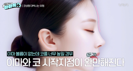 코 수술 성공을 위한 유형과 조건 확인 해보기 관련 이미지 8