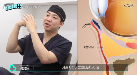 눈밑지방재배치 vs 하안검 vs 필러, 나는 어떤 케이스일까? | 압구정 바바성형외과에서 알려드립니다 관련 이미지 12