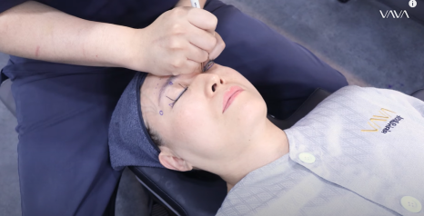 50대에도 자신감 가득 엄마의 두번째 리즈시절, 중년 눈성형&middot;하안검&middot;이마거상 리얼 후기 관련 이미지 5