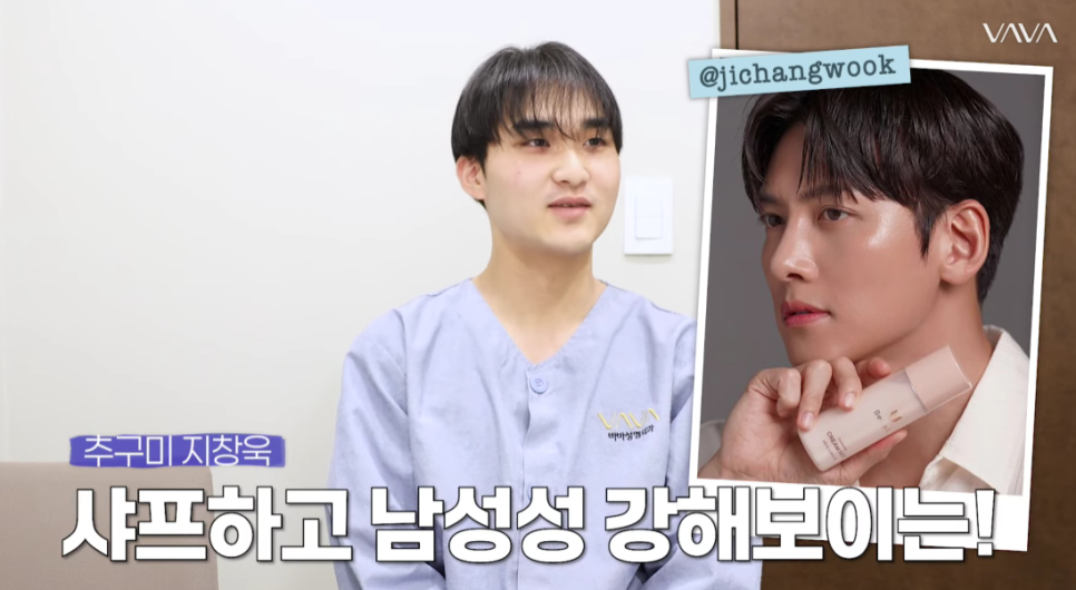 남자 코성형 리얼 후기 한 달 차 사례 비교해 보며 분석하기 관련 이미지 4