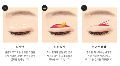 최준희 코 재수술 눈 재수술 성형 분석 관련 이미지 7