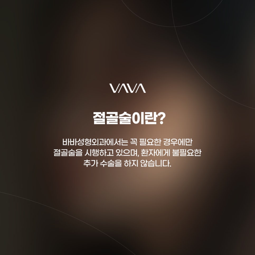 매부리코수술 교정법부터 체크할 사항 관련 이미지 7