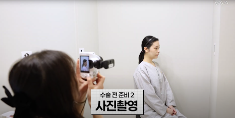 바바성형외과 절개 쌍수 절개 눈매교정 쌍꺼풀  재수술  사례 관련 이미지 13