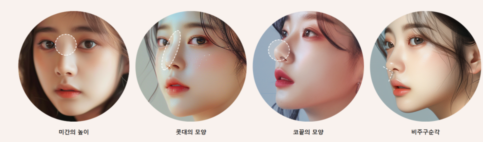 복코 수술전후 개선 된 인상 관련 이미지 11