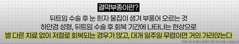 바바성형외과 절개 쌍수 절개 눈매교정 쌍꺼풀  재수술  사례 관련 이미지 16