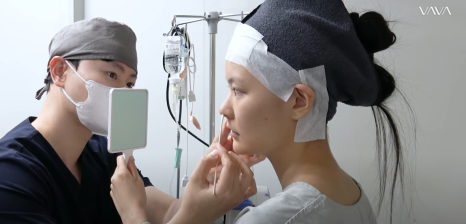 바바성형외과 복코&middot;매부리코&middot;휜코 동시 교정! 직반라인 코성형 리얼 후기 관련 이미지 8