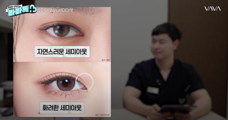 세미아웃라인 인아웃라인 쌍꺼풀 잘 받는 타입 (몽고주름) 관련 이미지 5