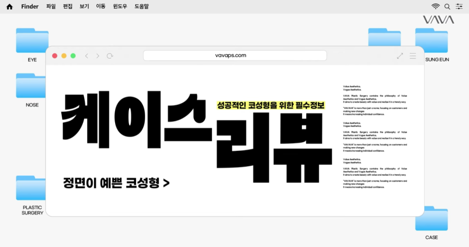 예쁜 코의 공통점은? 성형외과 원장이 알려주는 코 성형 성공하는 방법(리얼 후기 케이스) 관련 이미지 16