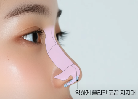 코재수술 원인, 과연 코끝처짐만이 문제일까? 가장 이상적인 라인 알려드립니다 관련 이미지 5