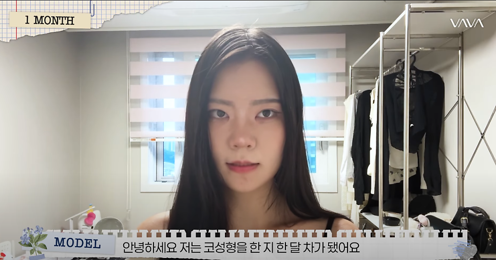 바바성형외과 복코&middot;매부리코&middot;휜코 동시 교정! 직반라인 코성형 리얼 후기 관련 이미지 13