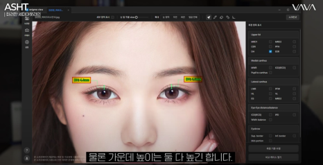 세미아웃라인 쌍수 장원영 쌍꺼풀 분석해 보기 관련 이미지 9