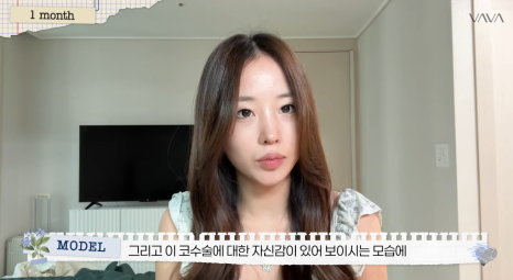 코재수술로 인상까지 달라질 수 있을까?｜바바성형외과 직반라인 코재수술 후기 관련 이미지 20