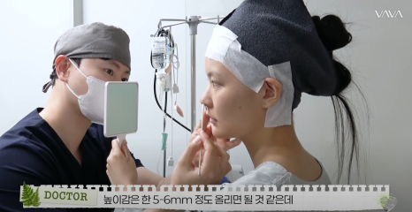 바바성형외과 복코&middot;매부리코&middot;휜코 동시 교정! 직반라인 코성형 리얼 후기 관련 이미지 5