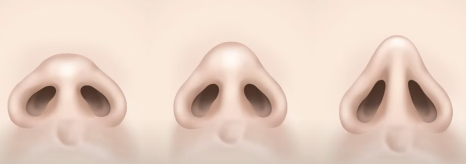 남성과 여성이 선호하는 코 라인의 차이점 관련 이미지 8