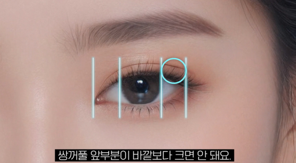 자연유착 vs 매몰 쌍꺼풀, 같은 비절개인데 왜 다를까요? 관련 이미지 17