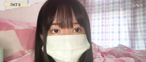 졸려보이는 눈 자연유착 밑트임 위트임으로 또렷하게 (리얼 후기) 관련 이미지 10