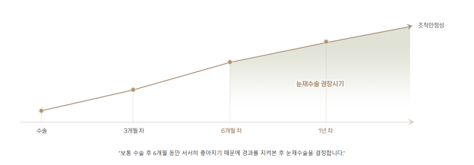 쌍꺼풀 재수술, 흉터 없이 가능할까? 관련 이미지 3