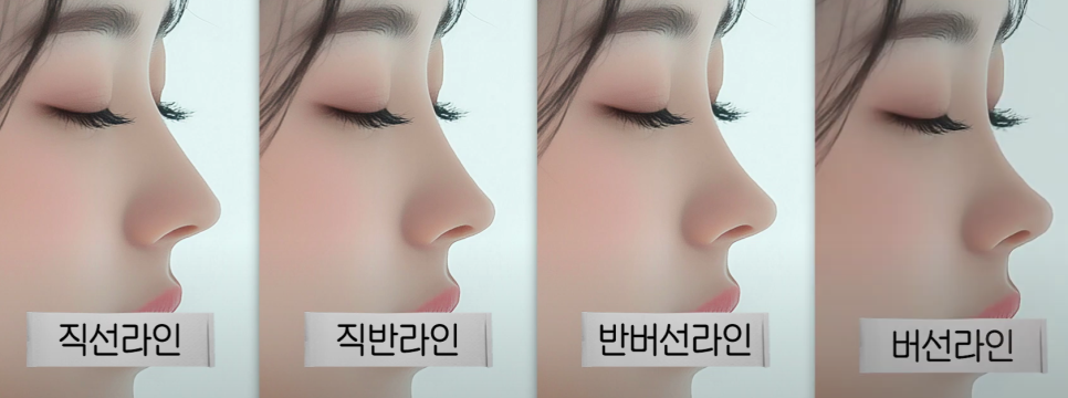 남성과 여성이 선호하는 코 라인의 차이점 관련 이미지 2