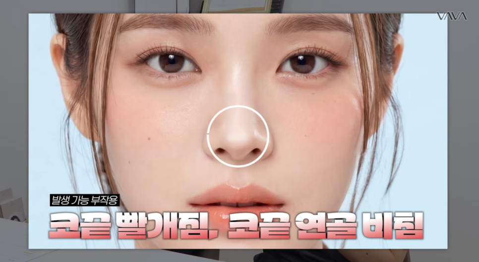 첫 코 성형, 언제&middot;어떻게 해야 할지 기준 정리해드립니다 관련 이미지 24