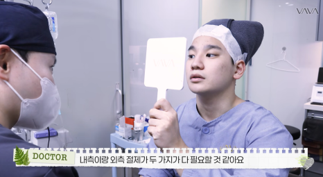 무보형물 직선라인 코성형으로 주먹코&middot;복코 개선｜압구정 바바성형외과 사례 관련 이미지 17