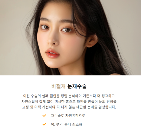 눈 재수술로 보다 완벽한 눈매라인 되찾기 관련 이미지 9