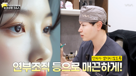 내 얼굴형에 맞는 코, 따로 있습니다 &mdash; 코성형 전 체크해야 하는 5가지 비율 관련 이미지 7