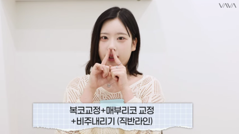 바바성형외과 눈&middot;코 성형 한 달 차 리얼 케이스 (윈터, 카리나 코) 관련 이미지 6