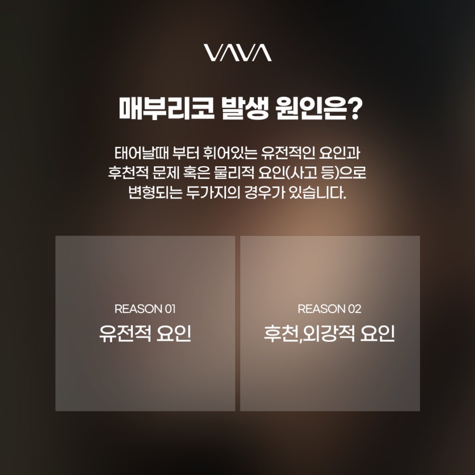 매부리코수술 교정법부터 체크할 사항 관련 이미지 3