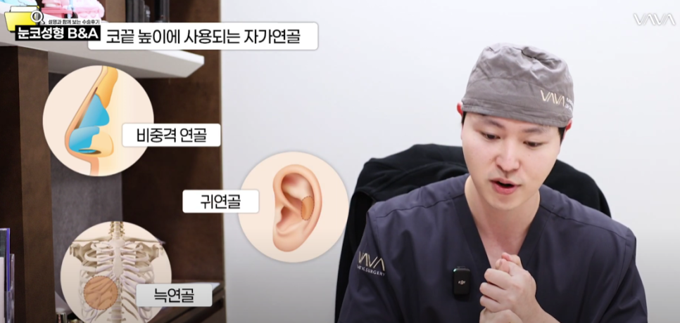 복코 매부리코 긴코 교정 ㅣ 코성형 전후 케이스 (NJZ민지 코) 관련 이미지 6