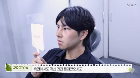 눈&middot;구축코 재수술 후기｜남자 눈코 재수술, 압구정 바바에서 달라진 이유 관련 이미지 18