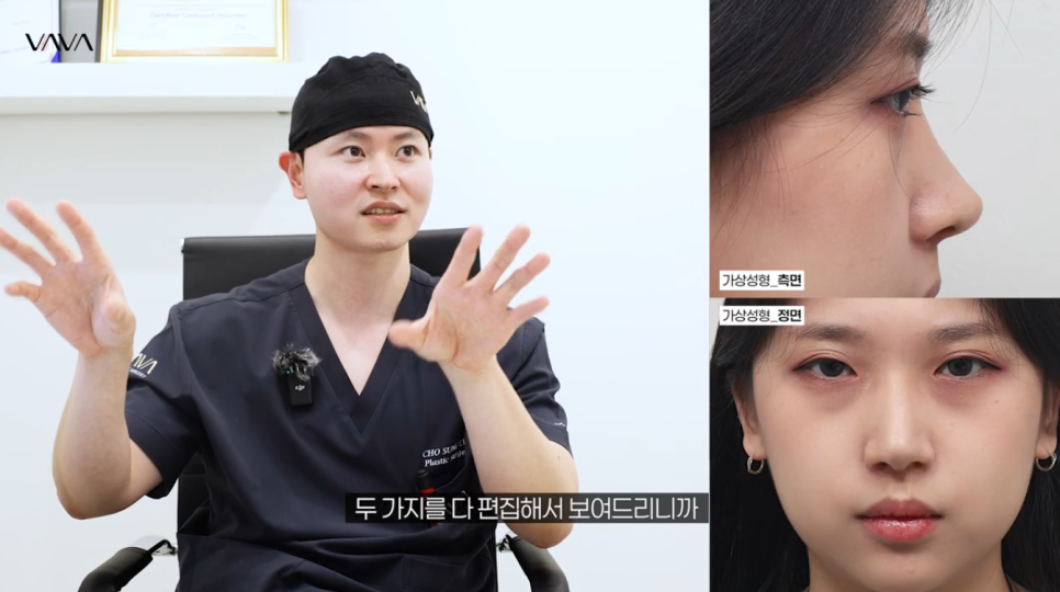 코수술 전 포토샵으로 결과를 확인하는 이유 ㅣ 바바성형외과 코수술 가상성형 상담 관련 이미지 4