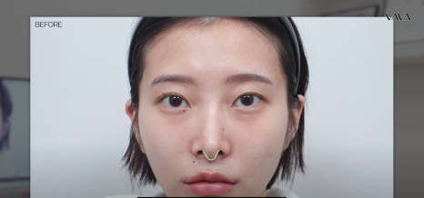 코재수술 원인, 과연 코끝처짐만이 문제일까? 가장 이상적인 라인 알려드립니다 관련 이미지 16