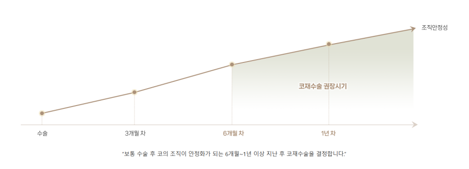 코끝 처짐 없이 자연스러운 맞춤 라인으로 관련 이미지 5