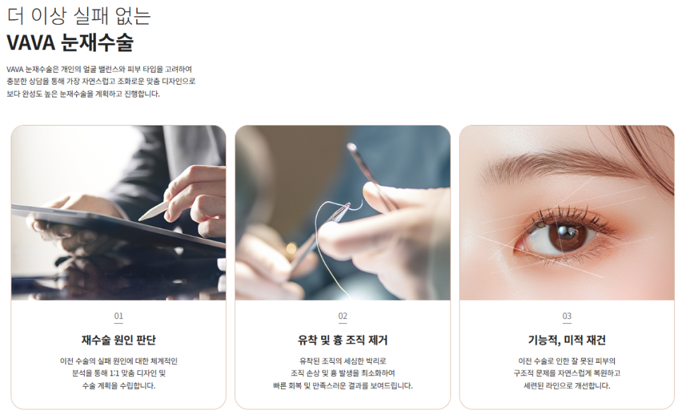 Revision Double Eyelid Surgery May Not Be Just a Line Issue | When Revision Eyelid Surgery Is Needed at Baba Plastic Surgery image 6