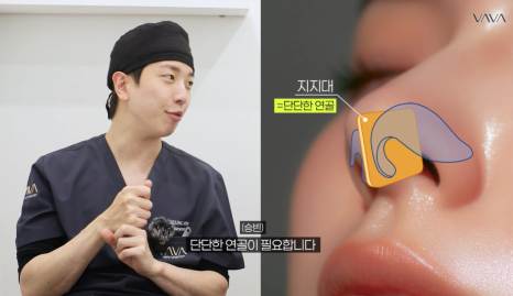 첫 코 성형, 언제&middot;어떻게 해야 할지 기준 정리해드립니다 관련 이미지 17