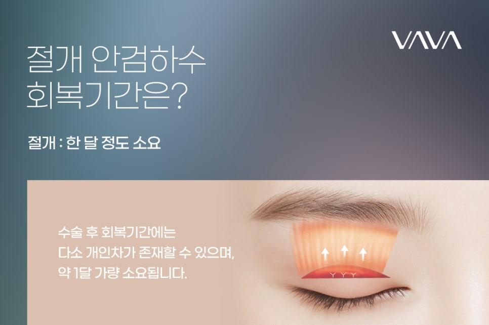 안검하수 회복기간 개인차가 있지만 관련 이미지 6