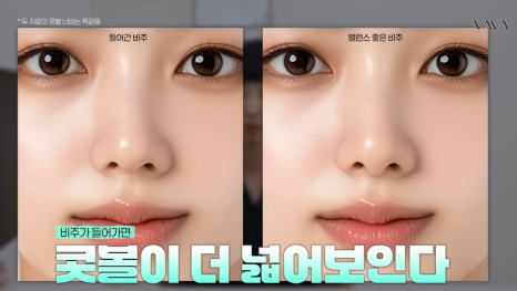 2026년 코성형 트렌드 예측콧대에서 코끝, 그리고 콧구멍까지 보는 시대 관련 이미지 8
