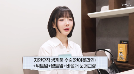 졸려보이는 눈 자연유착 밑트임 위트임으로 또렷하게 (리얼 후기) 관련 이미지 5