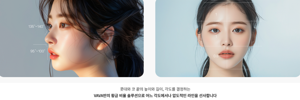 화려와 자연스러움의 중간 자려라인의 정석 직반라인 코 성형 관련 이미지 13