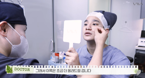 무보형물 직선라인 코성형으로 주먹코&middot;복코 개선｜압구정 바바성형외과 사례 관련 이미지 21