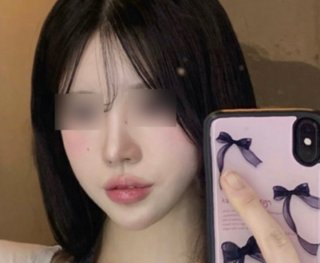 코 성형 단순한 외모 변화뿐일까? 관련 이미지 10