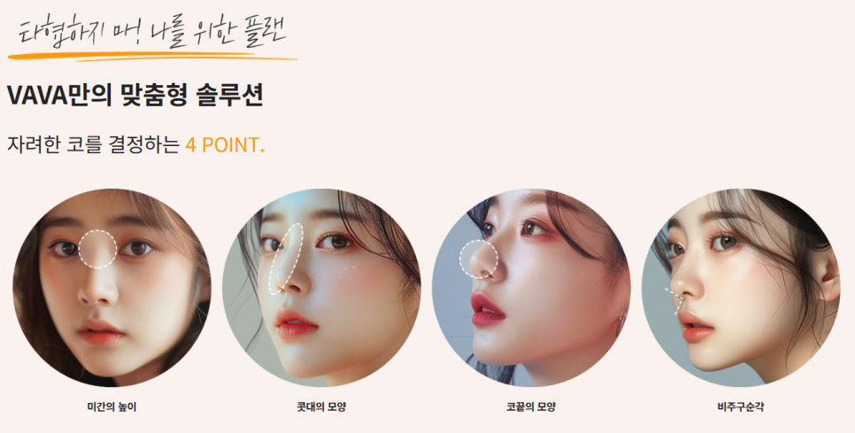 코성형, 단순한 높이가 아닌 얼굴 균형을 고려해야 하는 이유 관련 이미지 6