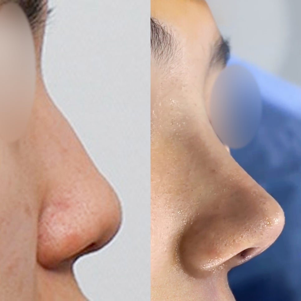 코유형에 따른 인상 관련 이미지 3