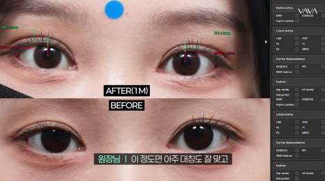 과하지 않게 또렷한 눈매, 세미아웃라인&middot;인아웃라인 쌍꺼풀 인기 이유 관련 이미지 12