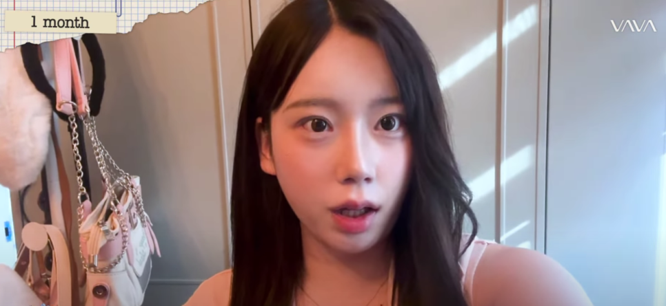 바바성형외과 눈&middot;코 성형 한 달 차 리얼 케이스 (윈터, 카리나 코) 관련 이미지 14